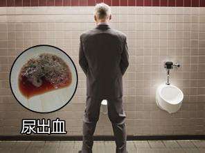 男性小便出血是怎么回事
