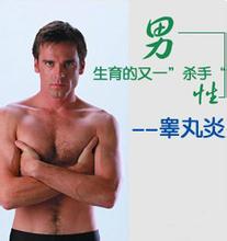 睾丸炎会不会传染给妻子?