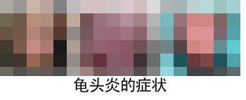 河池龟头炎检查哪家医院好?