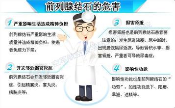 前列腺结石要做哪些检查?